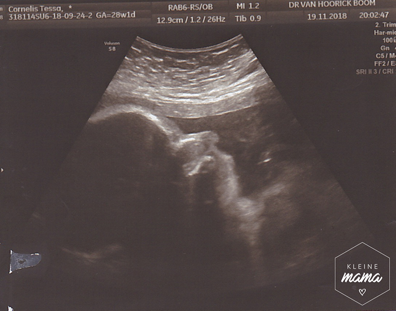 Echografie van 28 weken zwangerschap: babyhoofd in profiel